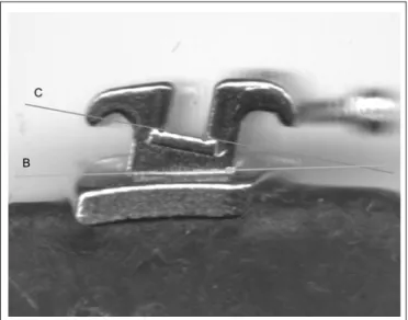 Fig. 3 – Reference lines used to measure torque angle. Line B, and line C.