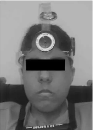 Figure 2. Side view of correctly positioned cervical range of  motion instrument (CROM).