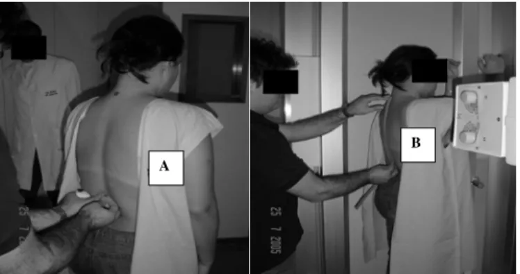 Figure 1 (A) shows the determination of the landmarks according to Field 10 . For the present study, a plumb marker was attached to the adhesive tape in order to determine the agreement between the placement of the external marker and the internal bone str