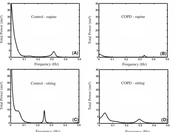 Figura 1. Graphic representation of power spectral density of a control group volunteer (A and C) and a chronic obstructive pulmonary disease group volunteer (B and D), in supine and seated position, respectively.