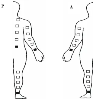 Figure 2. Schematic figure of the electrodes fixation places in the different segments and distances