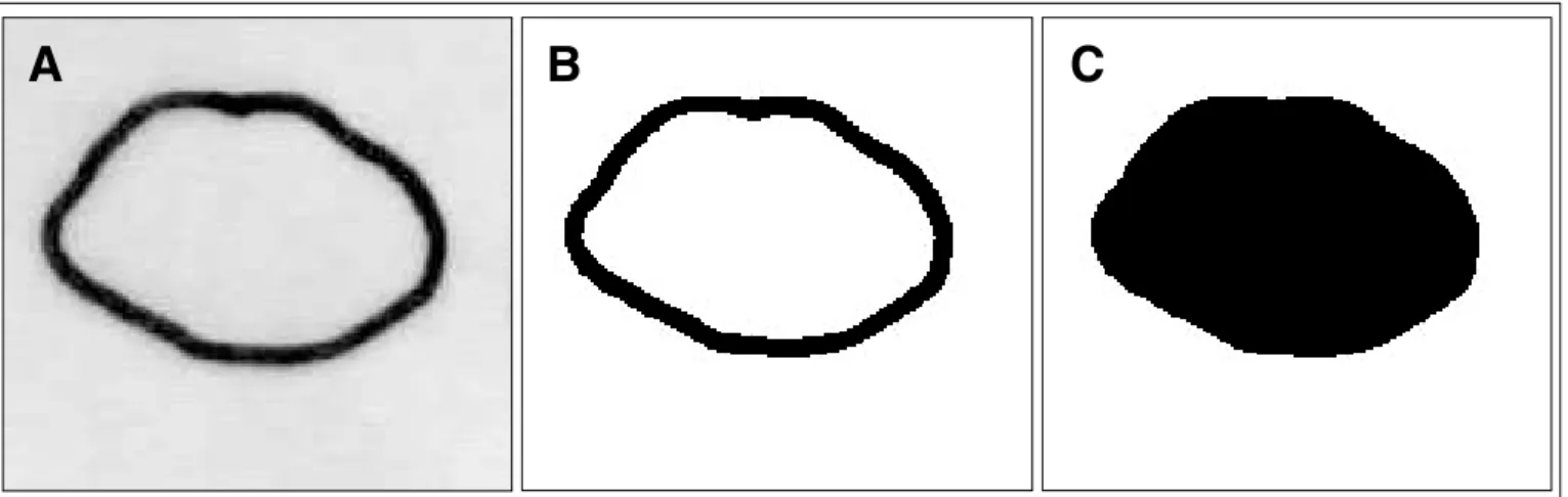 Figure 2 shows the box plot representation of the diffe- diffe-rences in area found in subgroups A (three days), B (seven  days), and C (14 days)