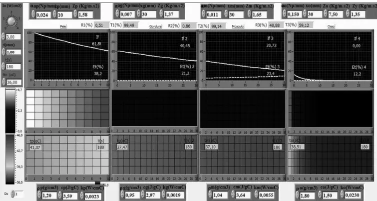 Figure 1. Software screen with the simulation of four tissue layers with TUS of 1 MHz and 3 W/cm2, during 180 seconds