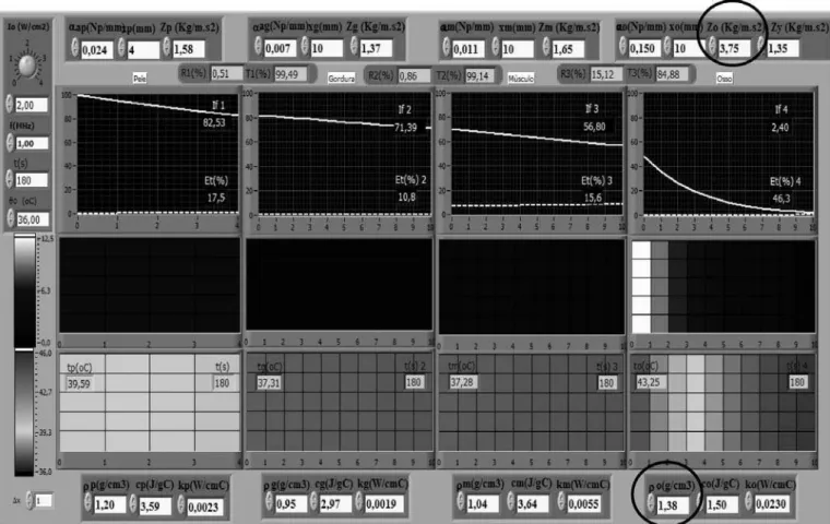 Figure 2. Software simulations with minimum values for bone density and acoustic impedance