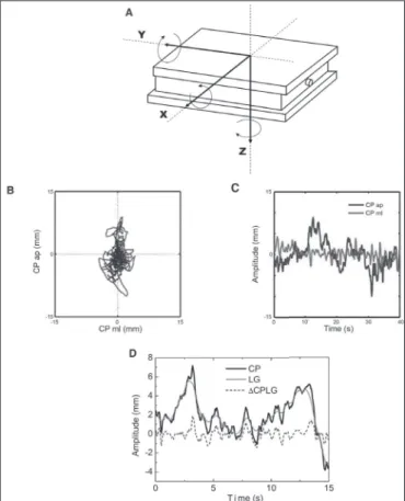 Figure 1. Representation of a force plate and measuring axes (A) and  examples of the statokinesigram (B) and of the stabilogram (C) of an  individual in the quiet standing posture for 40 seconds