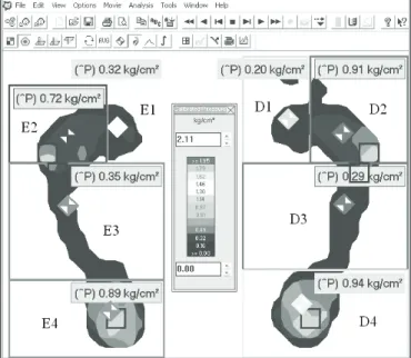 Figure 2. Separation of the feet in four areas in the FSCAN program  version 4.21.