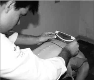 Figure 2. Evaluation performed with the scoliometer with the participant  standing in trunk flexion.