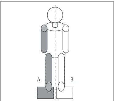 Figure 1. Illustrative scheme of the utilized positions to verify weight  bearing on the affected (A) and non affected (B) sides.