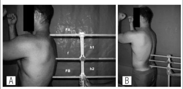 Figure 1. (A) Using the arcometer in the thoracic spine with identification  of the variables (FA, FB, f, h1 and h2) obtained with the instrument