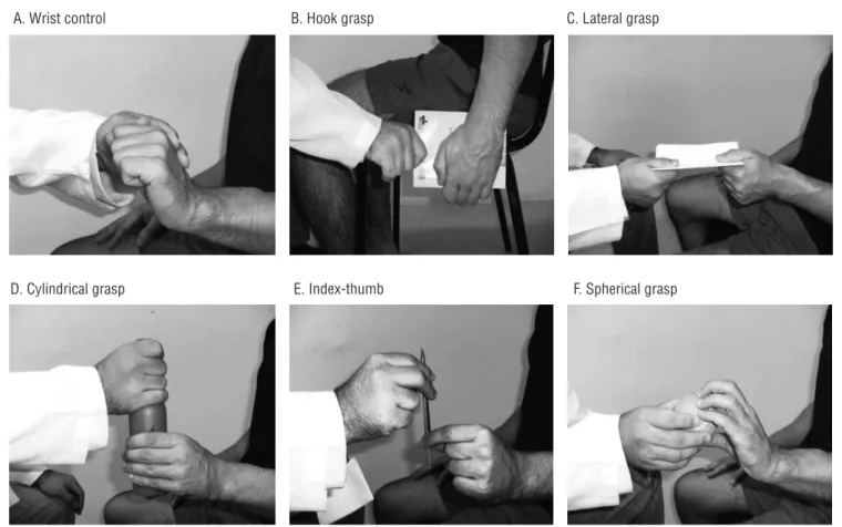 Figure 1. Items for upper limb section with examples of test to evaluate (A) wrist control, (B) hook grasp, (C) lateral grasp, (D) cylindrical grasp,  (E) index-thumb grip, and (F) spherical grasp.