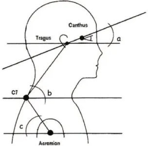 Figure 1. Adhesive marker placement and postural angles. a  sagittal head; b cervical angle; c shoulder angle.