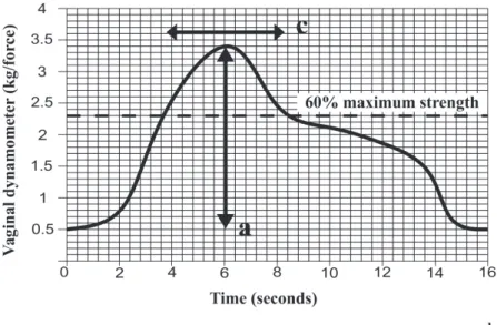 Figure 2. Illustration of the parameters used to analyze vaginal dynamometry data. a: Maximum strength: calculating the difference  between the highest and lowest strength values; b: Average strength: a mean value of the strength curve; c: Endurance: equal