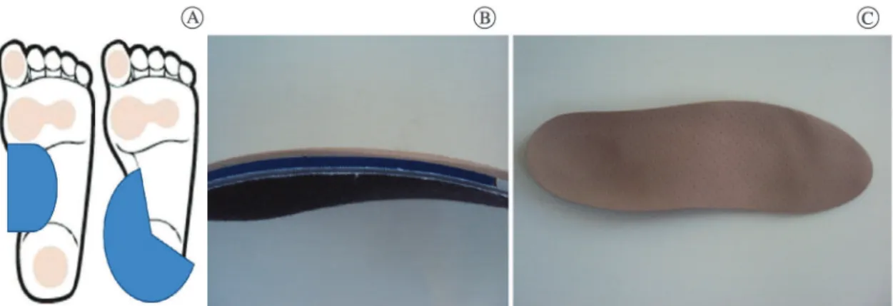 Figure 2. Representation of postural insole; 2A: Position of half-moon and anti-valgus elements; 2B: Side view of three layers of insole  after thermal molding; 2C: Top view of insole after thermal molding.