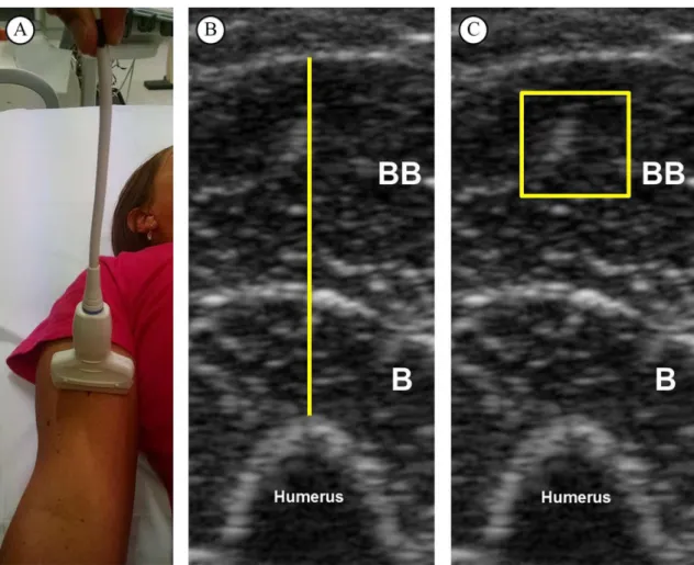Figure 1. Representative image from one subject. (A) Ultrasound scan of forearm lexor muscles