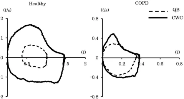 Figure 1. Representative low-volume curves during QB and CWC. The left side shows a healthy subject, and the right side shows a  COPD patient