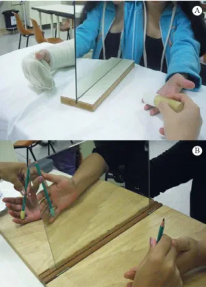 Figure 1. (A) Mirror placed in front of the patient with tactile stimuli  with textures on the irst post operative week for the Mirror Therapy  group; (B) Mirror placed in front of the patient with tactile stimuli  with textures after cast removal for the 
