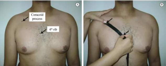 Figure 1. Bony landmarks used to represent pectoralis minor length (A) and measurement of pectoralis minor length taken with a tape  measure (B).