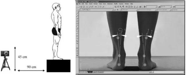 Table 1. Descriptive statistics (mean ± standard deviation) and comparisons between acute plantar fasciitis (FP) and chronic plantar  fasciitis (PF) regarding their demographic, anthropometric, and running practice characteristics.