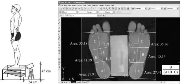 Figure 2. Image obtained by podoscope (A) and illustration of the areas of the feet to calculate the longitudinal plantar arch index (MLA),  where L: vertical line and areas A: rearfoot, B: midfoot and C: forefoot (B).