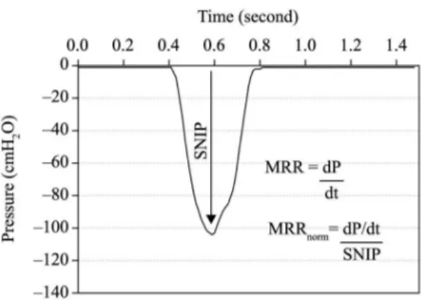 Figure 3 illustrates the kinetic pattern of SNIP tests  for a single individual with and without DiaphCtrl,  showing the shape of the SNIP curve and T total  for  the maneuver
