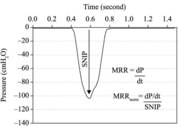 Figure 3 illustrates the kinetic pattern of SNIP tests  for a single individual with and without DiaphCtrl,  showing the shape of the SNIP curve and T total  for  the maneuver