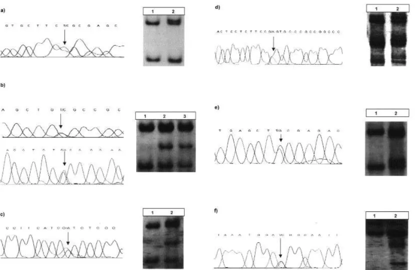 Figure 1. RET mutation analysis using direct sequencing and CSGE.