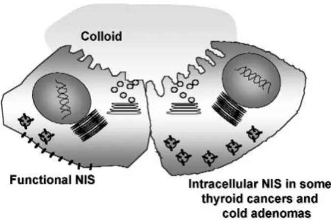 Figure 2. NIS localization in normal and tumoral thyroid cells. 