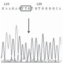Figure 1.  Representative (anti-sense) chromatogram of exon  10 of gene β of the thyroid hormone receptor in a patient  with resistance to thyroid hormone, showing the c.1345G&gt;T  (p.E449X) mutation in heterozygosis