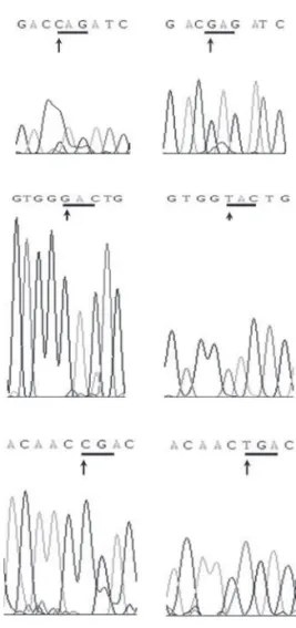 Figure 1. Direct sequence results of control samples (left  panel) and affected patients (right panels)