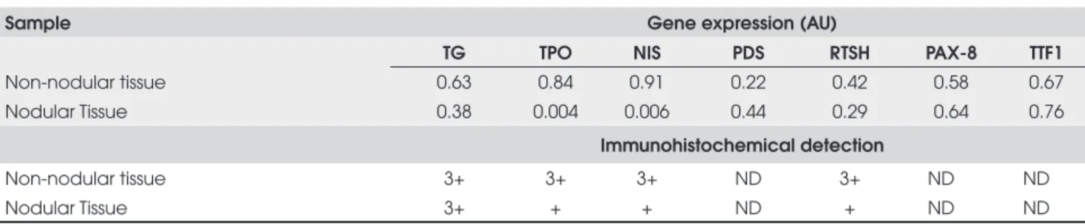 Table 4.  mRNA quantifi cation of TG, TSHR, NIS, PAX-8, TTF1 and PDS and Immunohistochemical analysis of TG, TSHR, NIS proteins in  nodular and non-nodular thyroid samples from patient 1