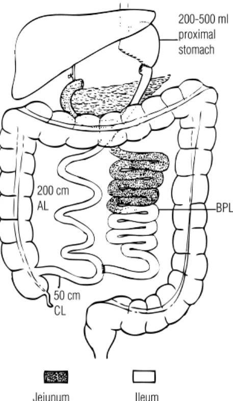 Figure  4.  The  malabsorptive  biliopancreatic  diversion  operation  results  in  rapid  entrance of food into the hindgut.