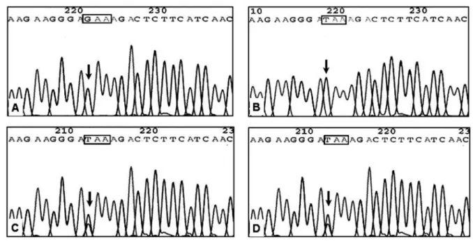 Figure 3. Electropherogram of  CASR  exon 5 fragment; the arrow points to nucleotide 1993 and the box shows the codon 519