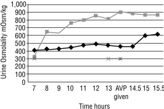 Figure 2. Urine and plasma osmolality and response to AVP in the patient  and control during dehydration test
