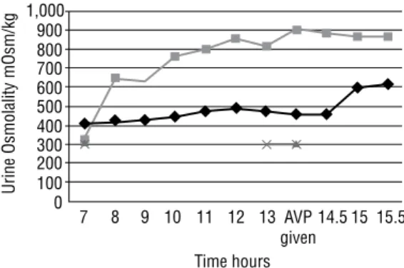 Figure 2. Urine and plasma osmolality and response to AVP in the patient  and control during dehydration test