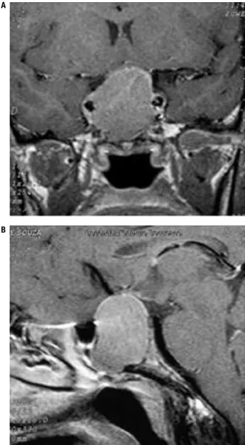 Figure 1. Magnetic resonance imaging of the sellar region (case 1).