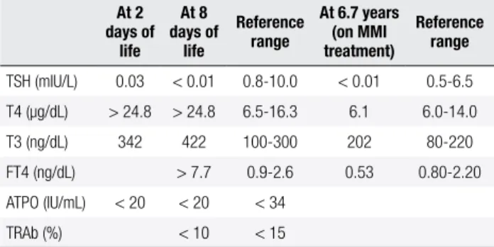 Table 1. Thyroid proile of the patient At 2  days of  life At 8  days of life Reference range At 6.7 years  (on MMI treatment) Reference range TSH (mIU/L) 0.03 &lt; 0.01 0.8-10.0 &lt; 0.01 0.5-6.5 T4 (µg/dL) &gt; 24.8 &gt; 24.8 6.5-16.3 6.1 6.0-14.0 T3 (ng