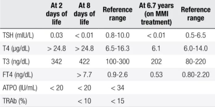 Table 1. Thyroid proile of the patient At 2  days of  life At 8  days of life Reference range At 6.7 years  (on MMI treatment) Reference range TSH (mIU/L) 0.03 < 0.01 0.8-10.0 < 0.01 0.5-6.5 T4 (µg/dL) > 24.8 > 24.8 6.5-16.3 6.1 6.0-14.0 T3 (ng