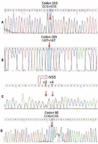 Figure 2. External genitalia of patients with HSD17B3 deiciency. Case 1  – igures A and B, and case 3 – igures C and D.