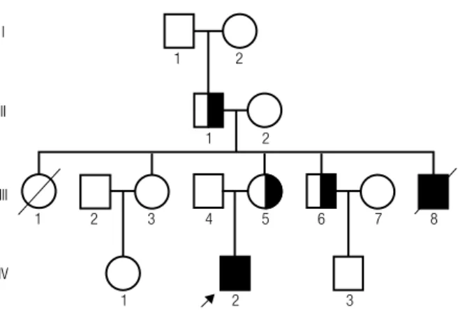 Figure 2. Schematic representation of patient’s mother’s (balanced) and  patient’s (unbalanced) translocation t(8;16)