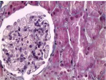 Figure 1. Glomeruli and tubulointerstitial area appear normal under light  microscopic examination (Masson’s trichromic stain, original magniication: 