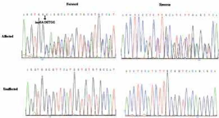 Figure 8. DNA sequence analysis of  MEN1  in unaffected and affected individuals in family II