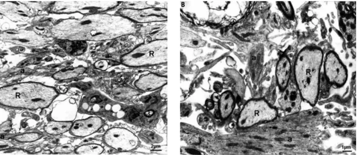 Figure 1. EB-induced lesions in groups I (A, diabetic) and III (B, non-diabetic) 15 days post-injection