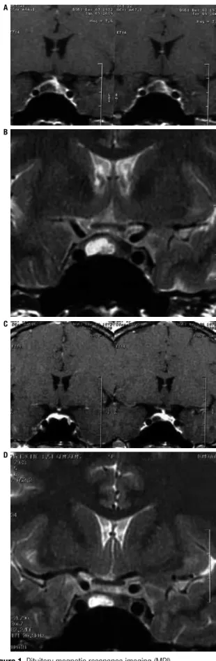 Figure 1. Pituitary magnetic resonance imaging (MRI).