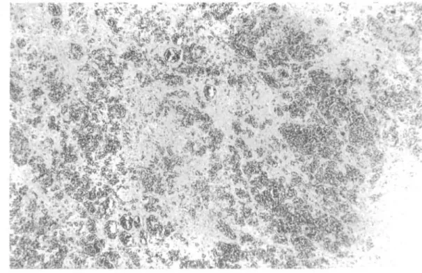 FIGURE 3 - M icroscopical section of the tum or show any sm all blood w ithin a m yxom atous strom a