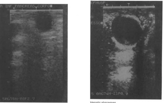 Table 6 IOUS-guided procedures Patient 1 . 2 . 3 . 4 . 5 . Procedure