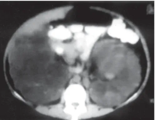Figure 1. Appearance of the kidneys via computed tomography scan.