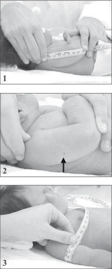 Figure 1. Mid-arm circumference: obtaining the measure- measure-ment. 1. length of the arm; 2