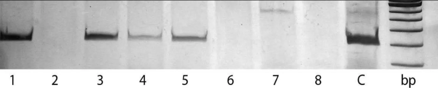 Figure 1. Detection of Epstein-Barr virus (EBV) DNA by polymerase chain reaction (PCR); electrophoresis on 10% polyacrylamide gels  in buffer TBE 1x; bp: DNA size marker; C: positive control, DNA from Raji cell line