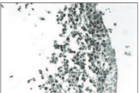 Figure 5. Dermis indistinguishable from the  epidermis. No extracellular matrix observed  in human skin obtained in a control  experi-ment of culturing (Masson’s trichrome  stain-ing; original magnification 400 x).