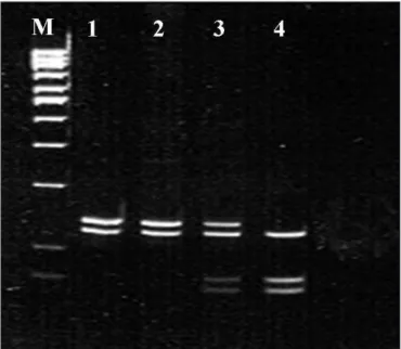 Figure 1. Polymerase chain reaction-restriction fragment length  polymorphism (PCR-RFLP) proile showing the polymorphisms in the  cyclin-dependent kinase inhibitor 1A (CDKN1A) gene